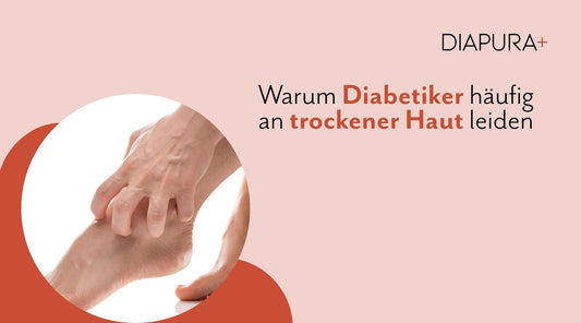 Warum Diabetiker häufig an trockener Haut leiden