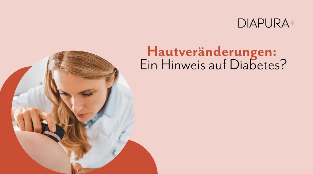 Hautveränderungen - ein Hinweis auf Diabetes?